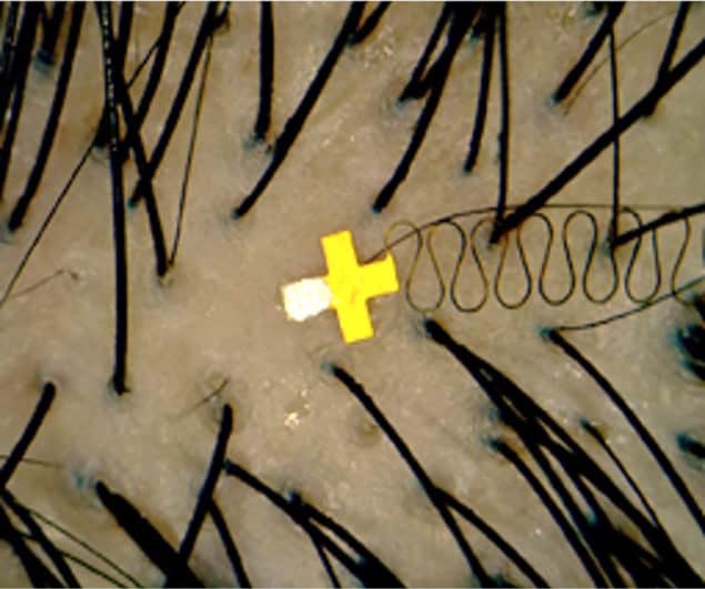 Microscale brain sensor between hair strands