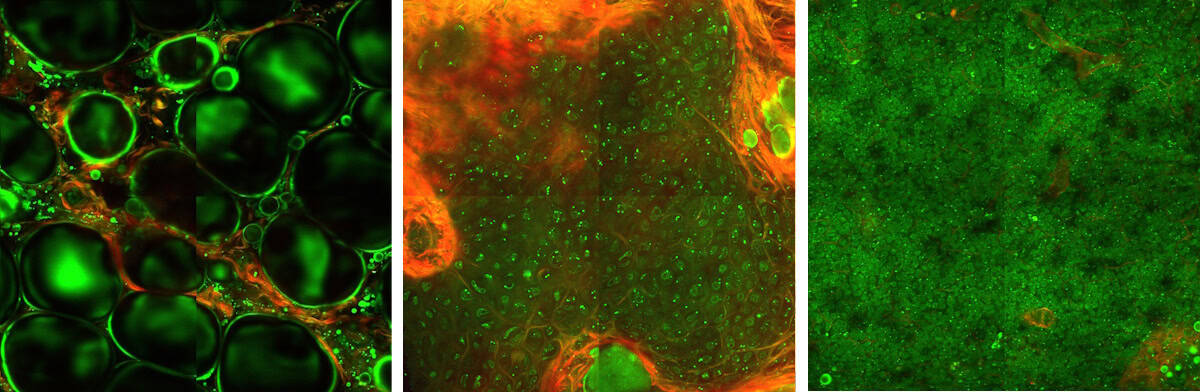 Multiphoton microscopy of adipose tissue, cartilage and lymphatic tissue