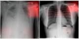 Images from a radiology deep learning model