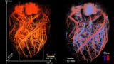 Mapping the coronary network of a pig heart